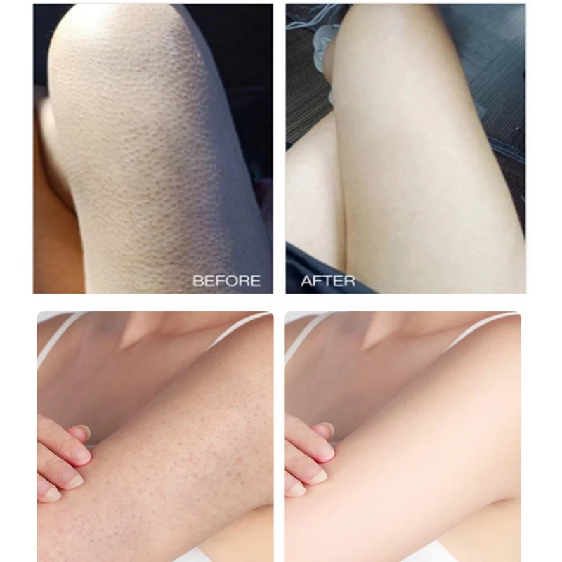 Shea Butter Body Scrub Moisturizing Exfoliating Remove Dead Skin Softens Exfoliator Crea : | Красота и здоровье