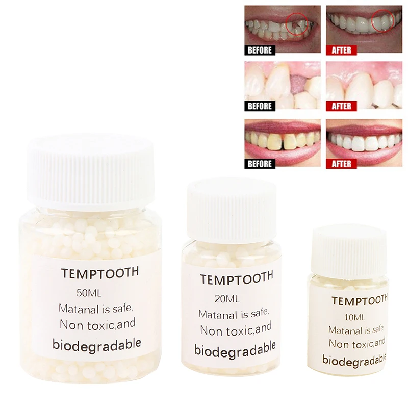 

Полимерный твердый клей FalseTeeth, набор для временного ремонта зубов, клей для зубов и зубов