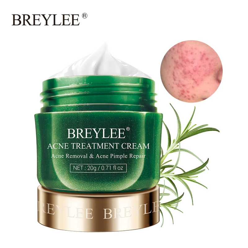 

BREYLEE Acne Treatment Cream Anti Acne Face Cream Pimple Removal Spots Oil Control Shrink Pores Moisturizing Skin Care Serum 20g