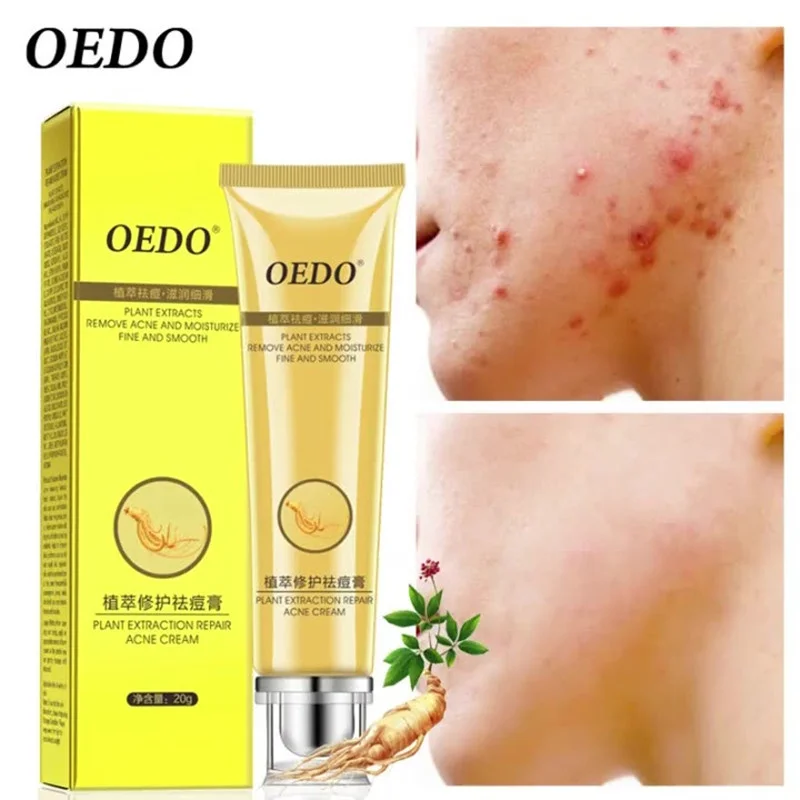 

OEDO Ginseng Acne Removal Cream Acne Treatment Gel Oil Control Remove Pimples Shrink Pores Fade Acne Spots Facial Skin Care 20g