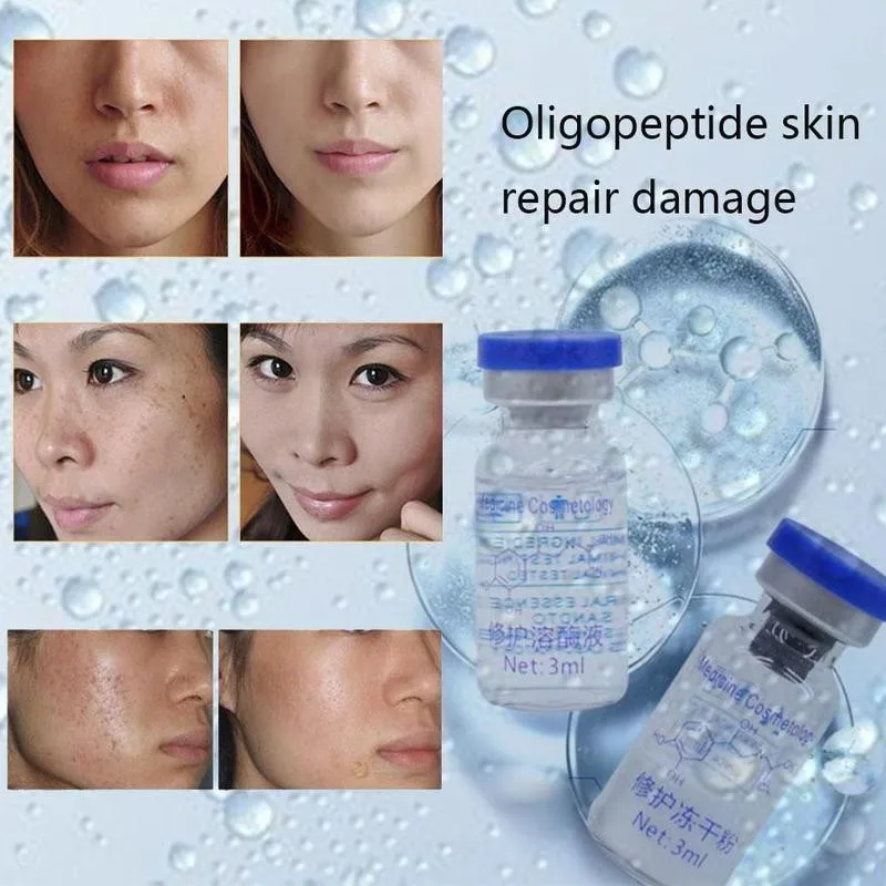 Oligopeptide Freeze-dried Mask Epidermal Growth Factor Pimples Scars Care Acne Serum Treatment Skin Wrinkles Powder S8C4