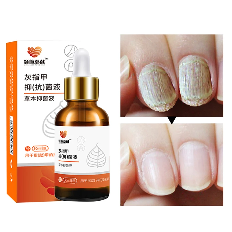 

45g Nail Treatment Repair Gel Broken Nail Treatments Nail Growth Product m1