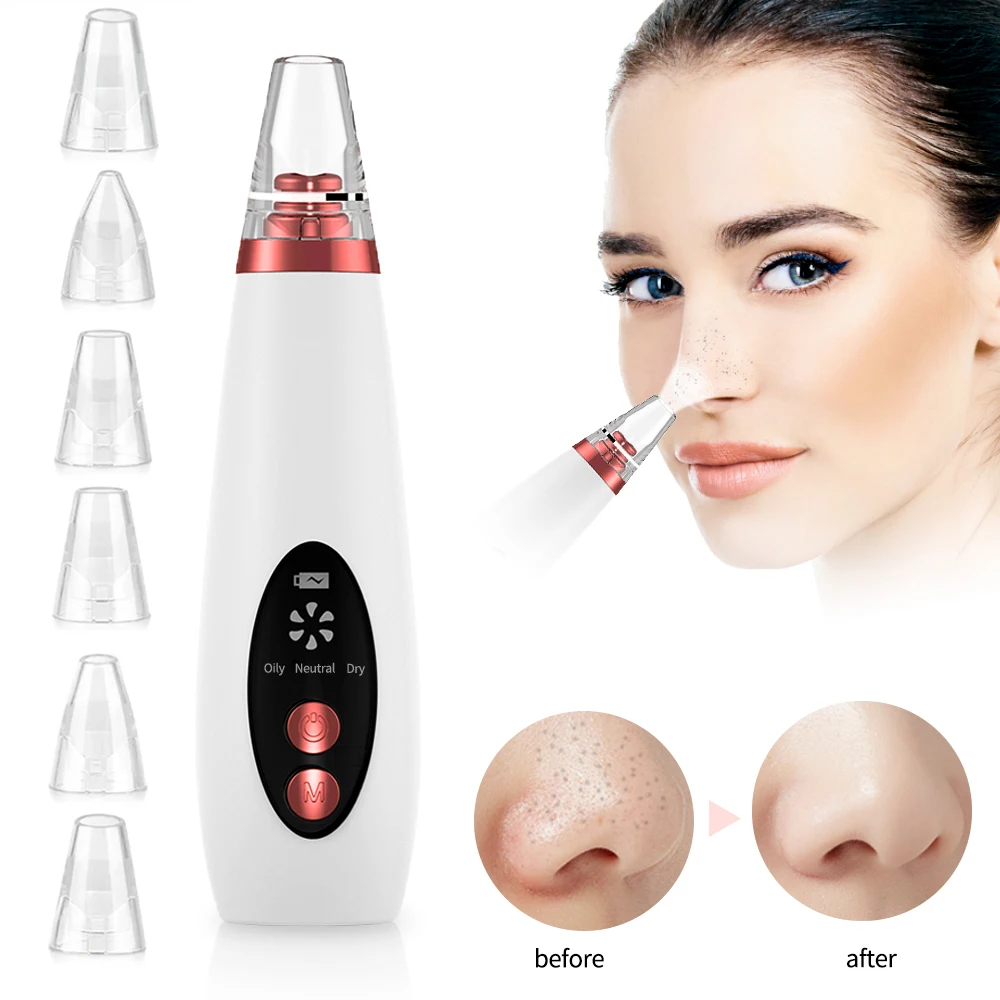 2020 USB средство для удаления черных точек вакуумное на лице и пор ухода за кожей