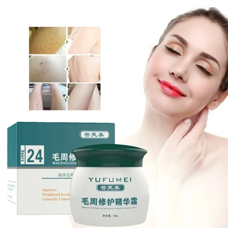 50g Curing Keratosis Pilaris/ Kp/ Chicken Skin Body Lotion Skin Repair Cream Skin Care Essence Moisturizing And Nourishing