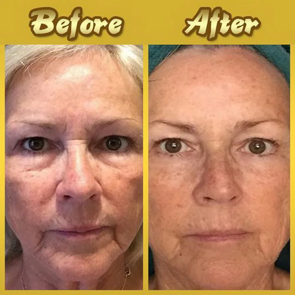 Отшелушивающая маска для лица отбеливающие маски против морщин Уход за кожей