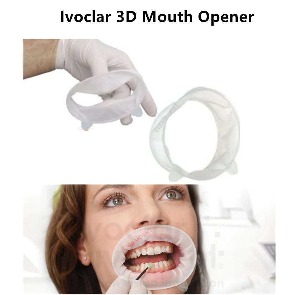 Ремешок OptraGate 3D для щек губ зубной рот обычный маленький младший детский взрослый