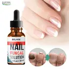 Средство для лечения Ногтей от грибков ELECOOL, эссенция для ухода за ногами, отбеливание ногтей на ногах, удаление грибка на ногтях, гель для удаления инфекции, восстанавливающая эссенция, уход