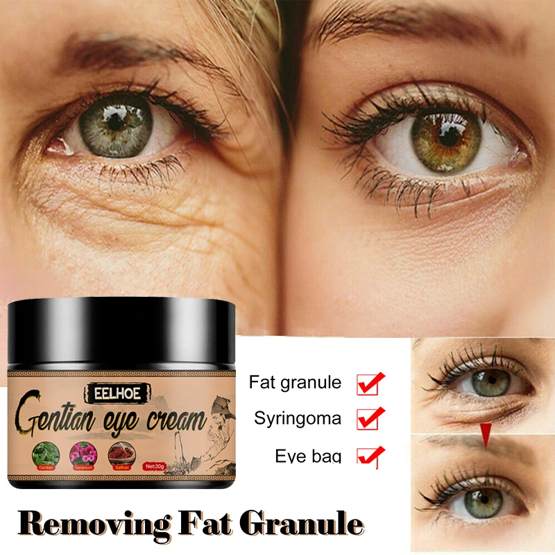 

Eelhoe Natural Eye Cream Remove Dark Circle Bags Under The Eyes Prevent And Improve Fat Particles Improve Eye Skin Care TSLM2