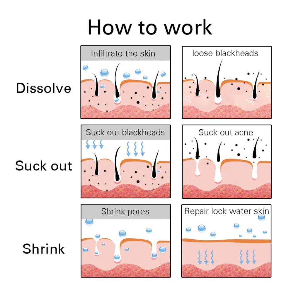 5 шт. очистка пор на носу с бамбуковым углем черным и белым цветом|Средство для