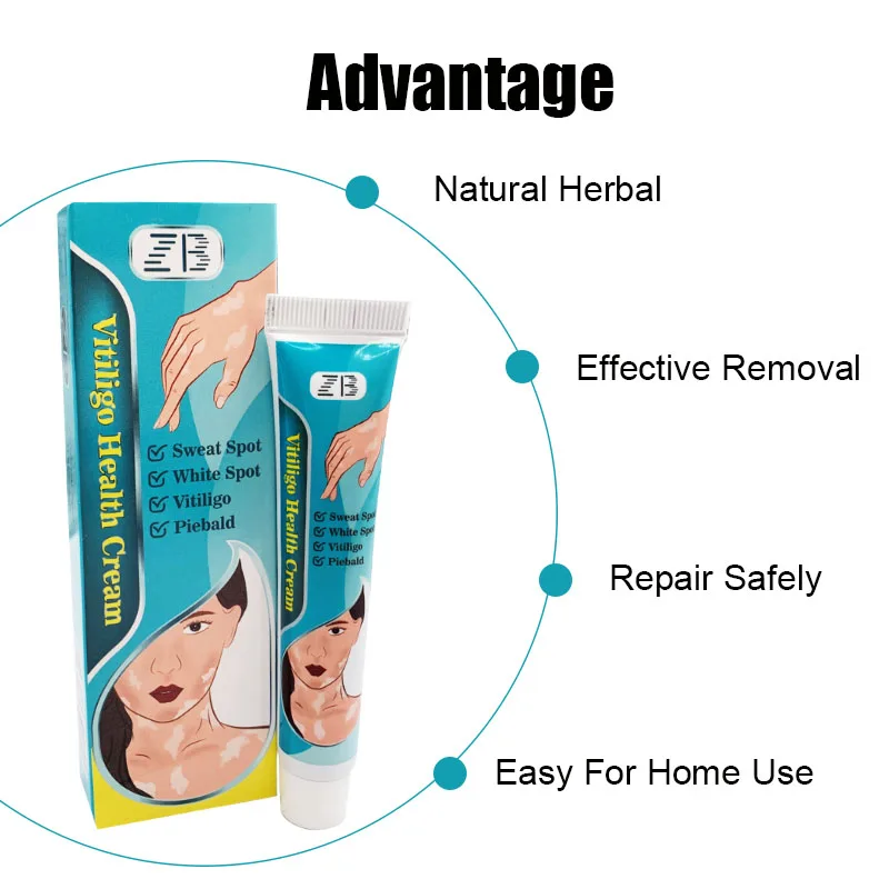 ZB Vitiligo Treatment Cream Sweat Spot Piebald Remove Herbal Medicine Plaster Versicolor Pityriasis Eczma Cure Skin Care Balm | Красота и