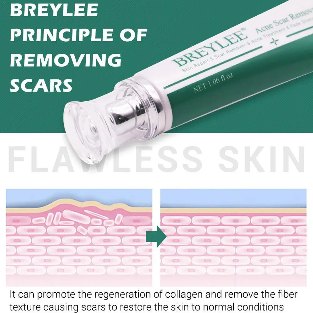 Гель для удаления шрамов от акне BREYLEE сыворотка пятен прыщей и пигментации кожи