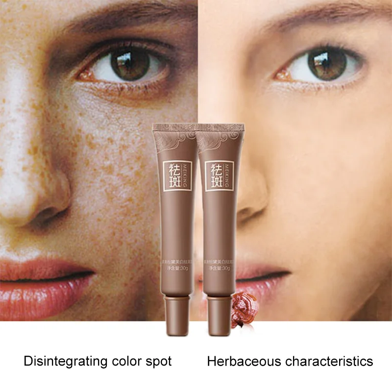 Уход за кожей пигментный крем для лица с эффектом меласмы удаления веснушек