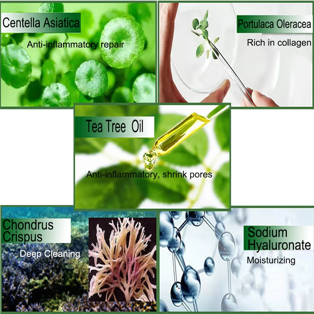 Крем для лица от акне шрамов черных точек контроль жирности сужение пор