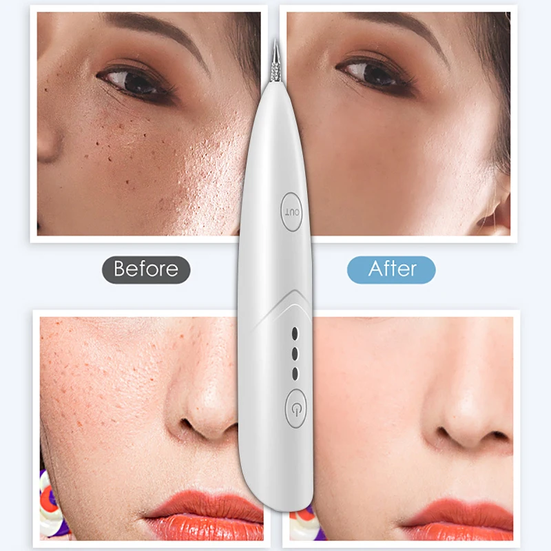 Профессиональная плазменная ручка для красоты пигмент темных точек удаление