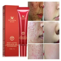 15g herbal anti acne repair fade acne spots oil control whitening moisturizing face gel effective acne removal cream skin care