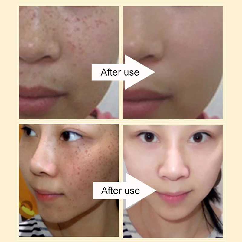 

Niacinamide Cream Moisturizing Whitening Concealer Cream Moisturizing Skin Cosmetics For Women CIN6 899