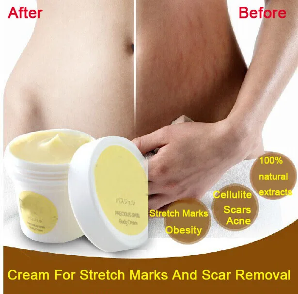 

24pcs/lot Pasjel Cream For Stretch Marks And Scar Removal Powerful To Stretch Marks Maternity Skin Body Repair Cream