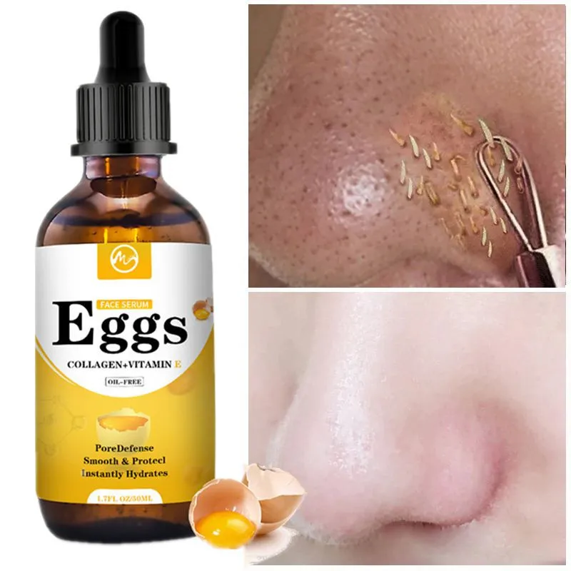 

Minch Egg Face Serum Blackhead Remove Essence Pore Minimizer Oil Control Shrink Pores Serum Whitening Serum Korea Skin Care Oil