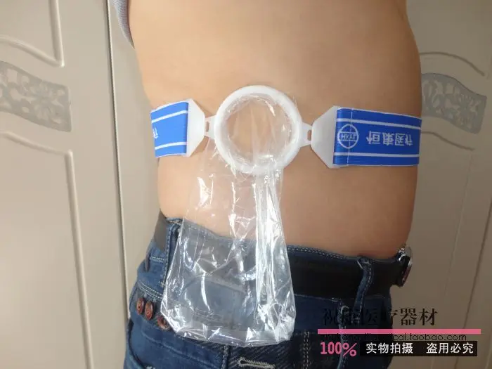 Анальный пояс-мешок для стомии искусственный анальный туалет Круглый Ректальный