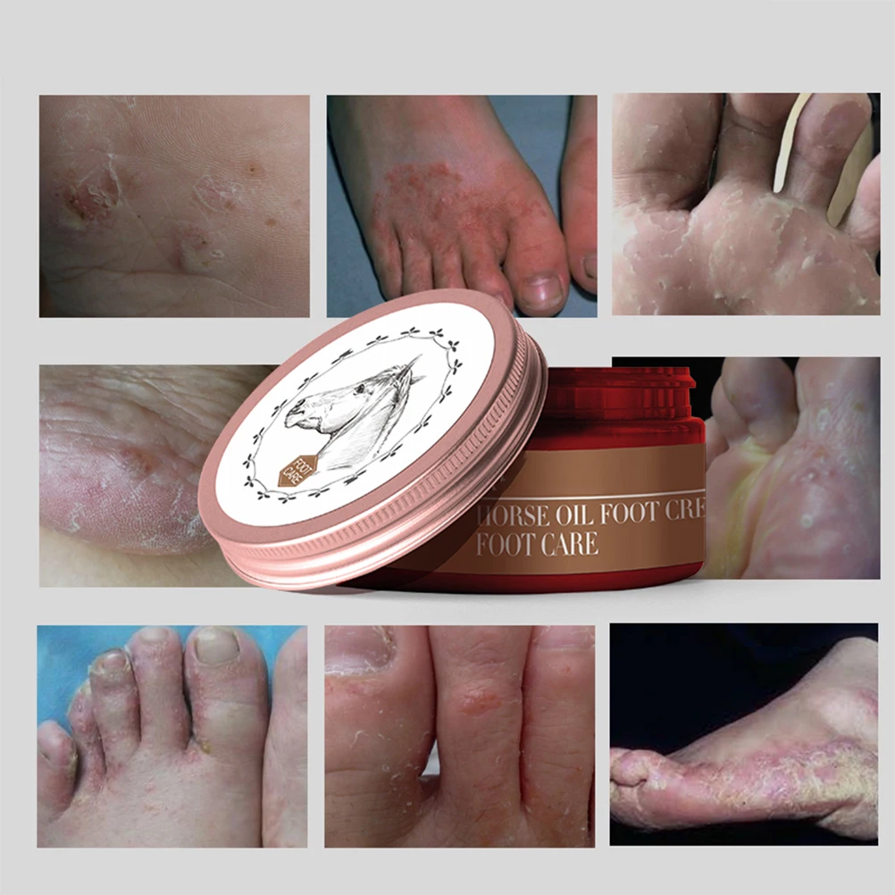 Крем для ног с конским маслом увлажняющий крем восстановления зуда снятие кожи и