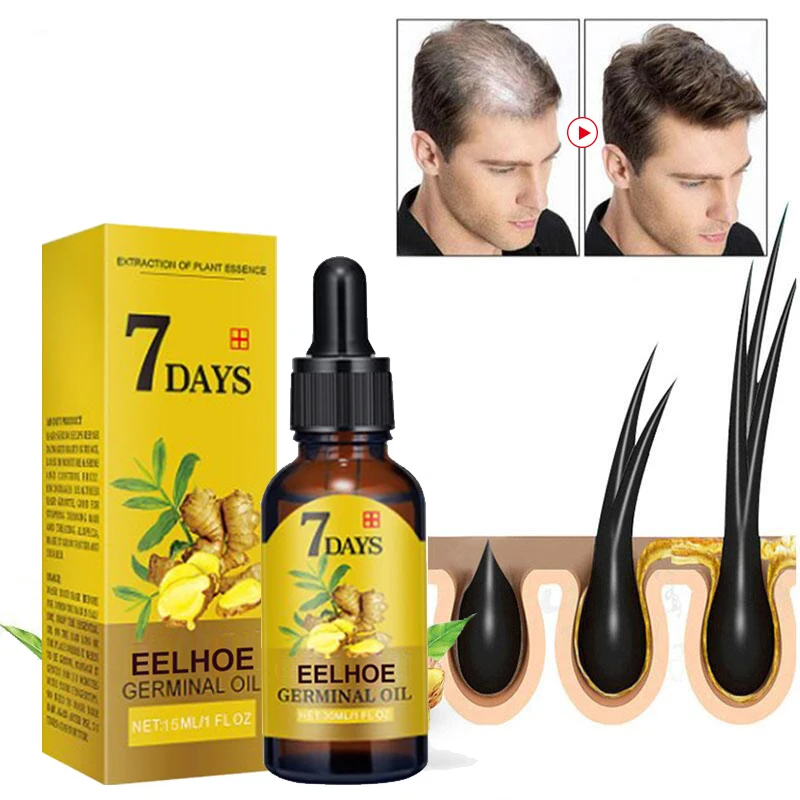 

Ginger Hair Growth Essential Serum Oil Anti Hair Loss Product Nourish Hair Roots Prevent Dry Frizzy Damaged Thinning Repair Care