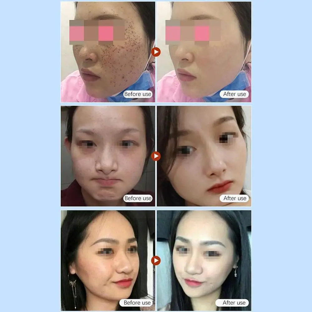 

Concealer Freckle Freckle Cream Pores And Acne Cover Long-lasting Tattoo Makeup Cover Face Contour P1p8