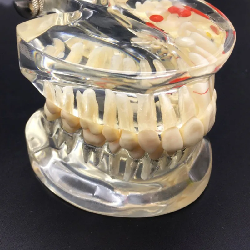 Стоматологическая полубоковая Съемная патологическая модель зубов для взрослых