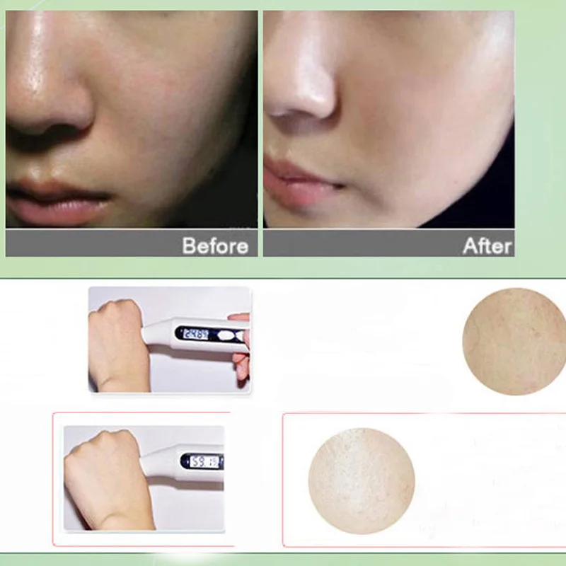 1 шт красота уход за лицом алоэ вера морские водоросли растение коллаген