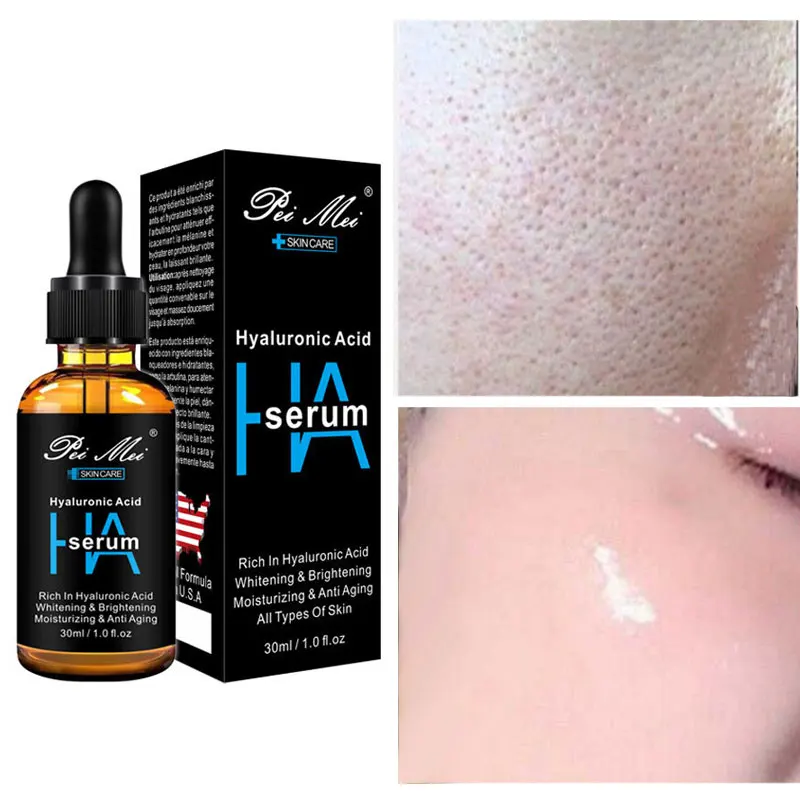 Гиалуроновая кислота уход за кожей лица Сыворотки увлажняющий Отбеливание и