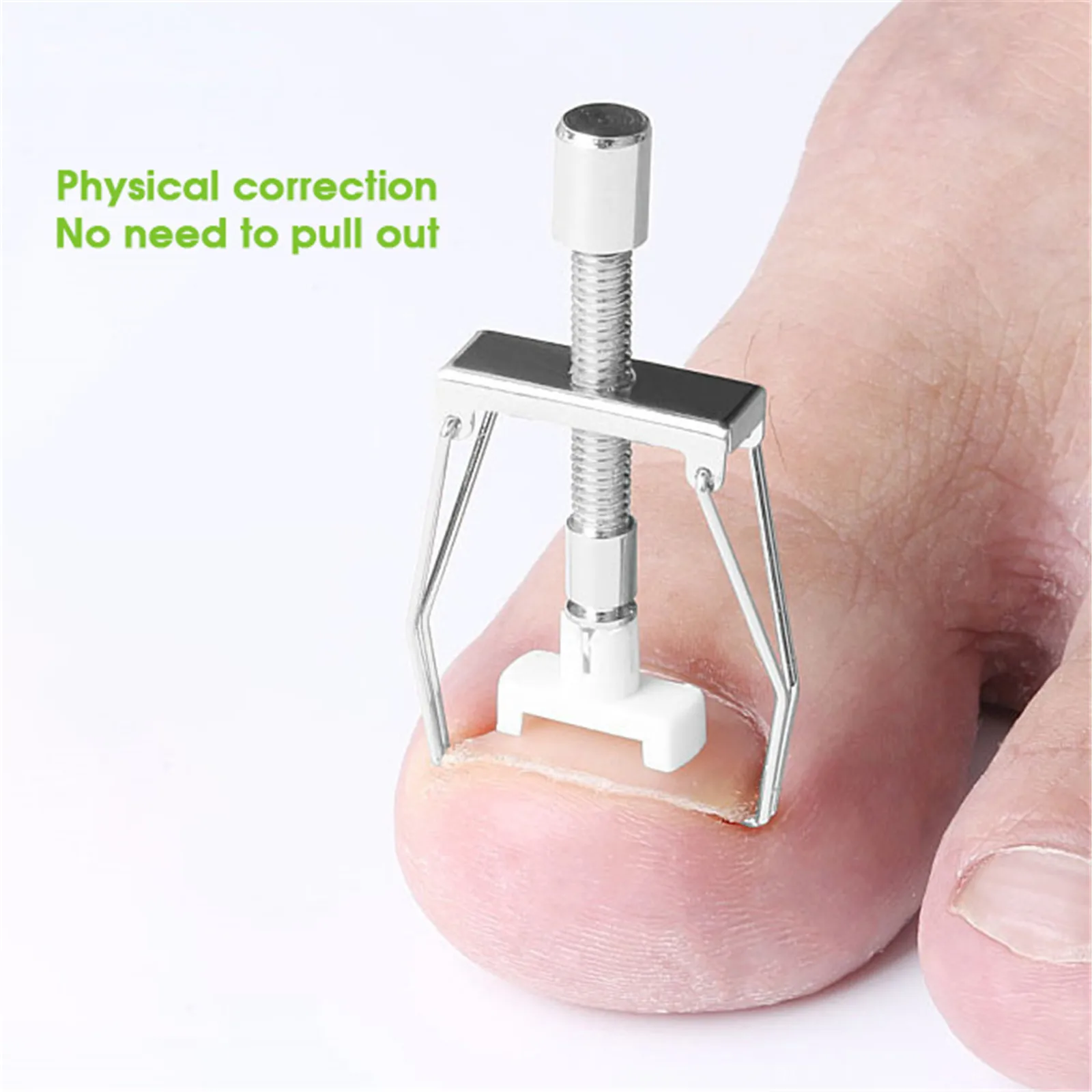 

Ingrown Nail Recover Correction Pedicure Toenail Fixer Ingrown Foot Nails Care Tool Orthotic Toe Nail Corrector Pedicure Tool