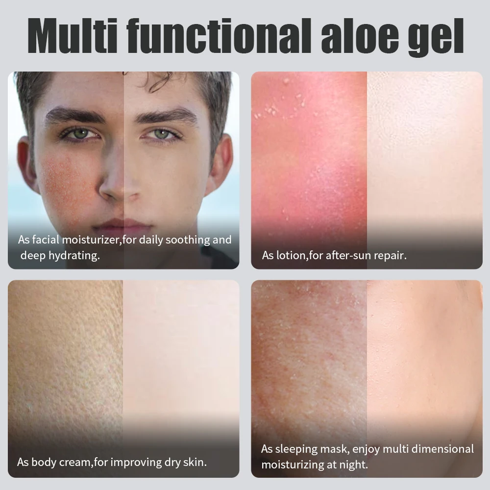 Натуральный успокаивающий гель с алоэ вера для ухода за кожей удаления акне