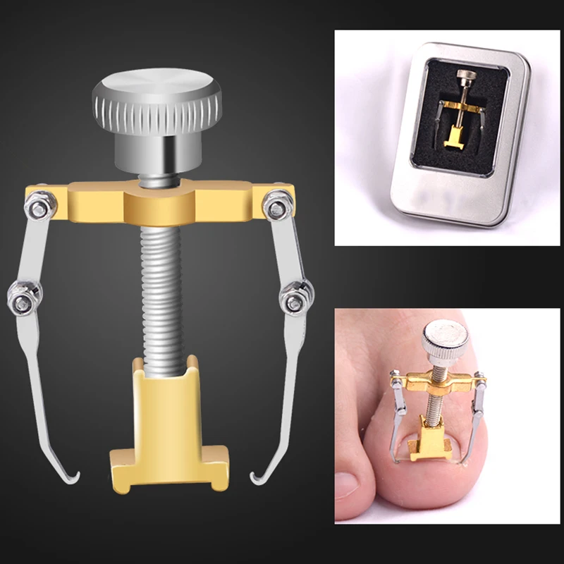 Средство для ухода за вросшими ногтями корректор ногтей профессиональное