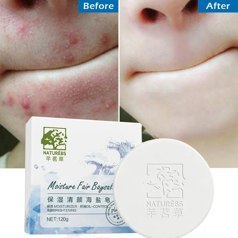 WXE 100% натуральная морская соль мыло Очиститель Удаление прыщей поры лечение акне