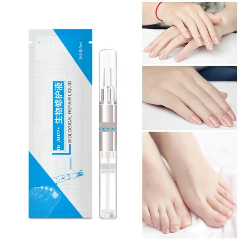 3 мл ручка для ногтей пальчиковые ногти онихомикоз пароникья инфекция флакон