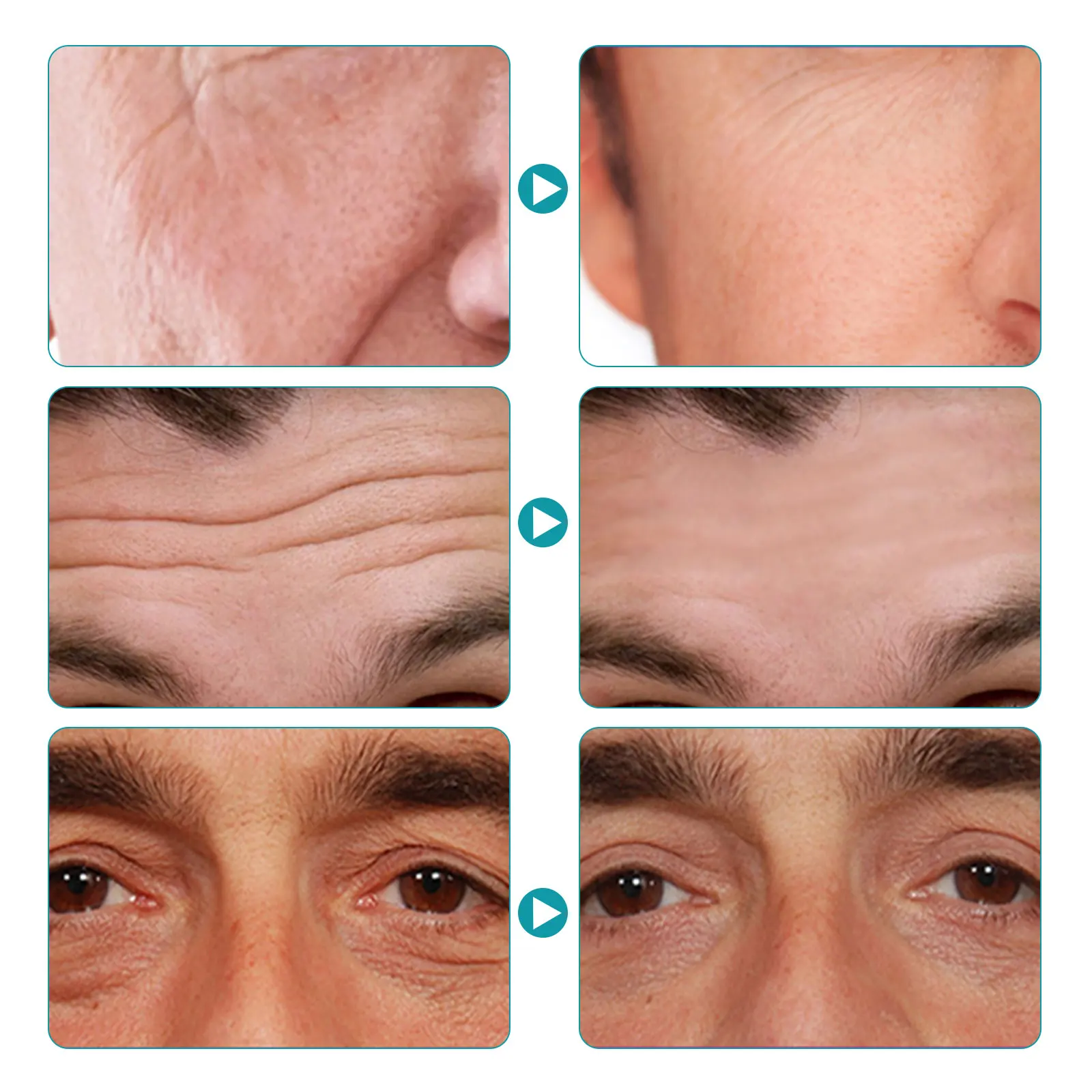 30g Men Anti Aging Face Cream Skin Care Deep Hydrating Moisturizing Whitening Oil-control |