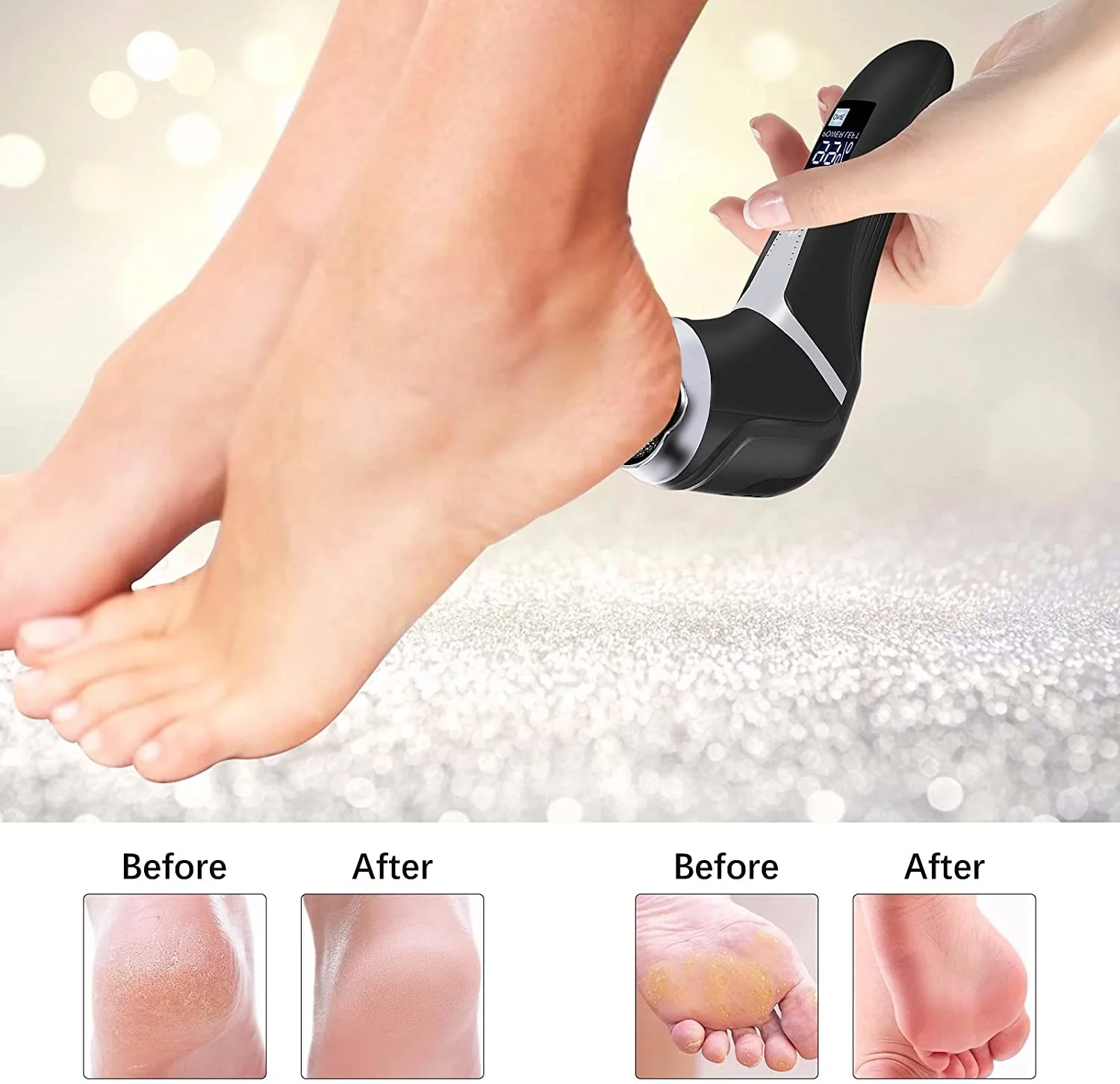 

Electric Foot File Rechargeable Waterproof Hard Skin Remover Foot with 3 Rollers Foot Files for Hard Skin and Dead Skin