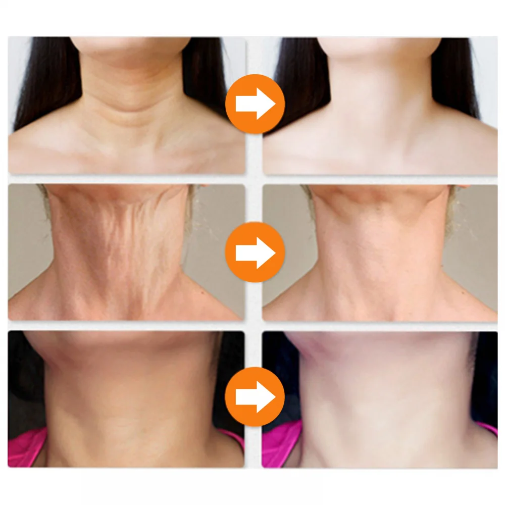Neck Firming Wrinkle Remover Cream Rejuvenation Skin Whitening Moisturizing Shape Beauty Care Products | Красота и здоровье