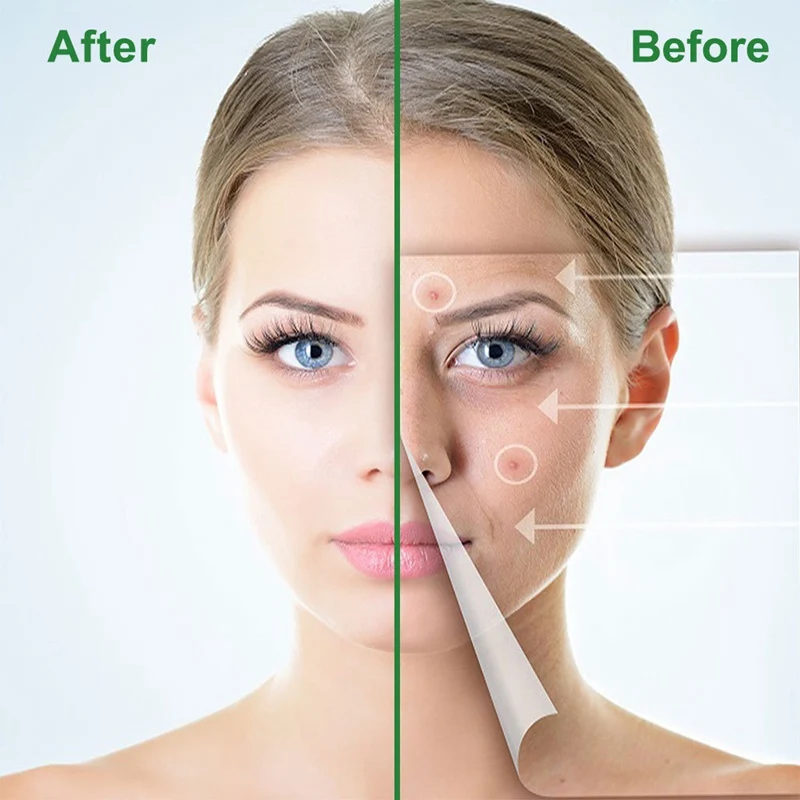 ELAIMEI Tea Tree Acne Patch Hydrocolloid Waterproof Clear Pimple Patch Acne Treatment Patch