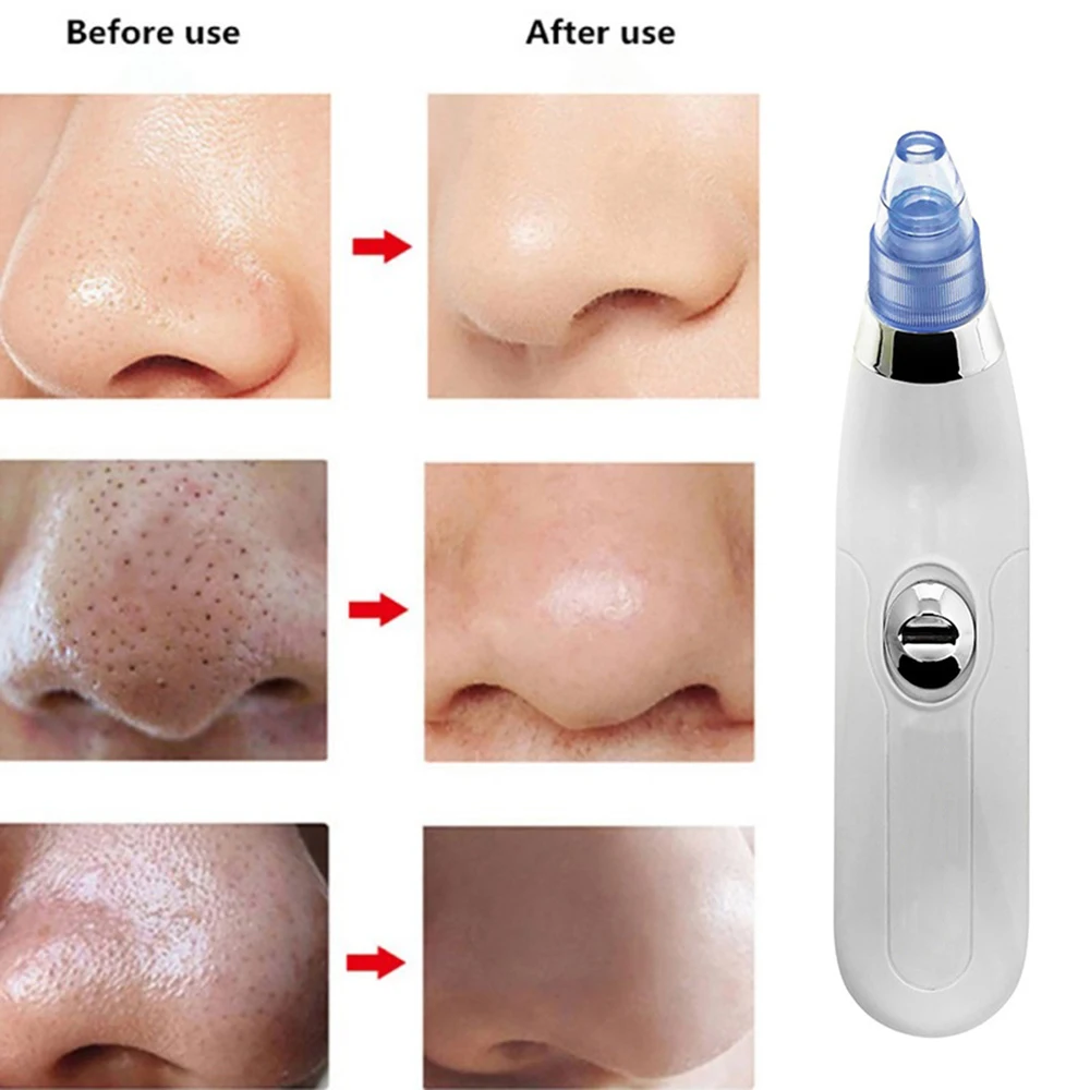 

newBlackhead Remover Skin Care Pore Vacuum Cleaner Face Nose Deep Pore Acne Pimple Removal Vacuum Suction Facial Diamond Machine