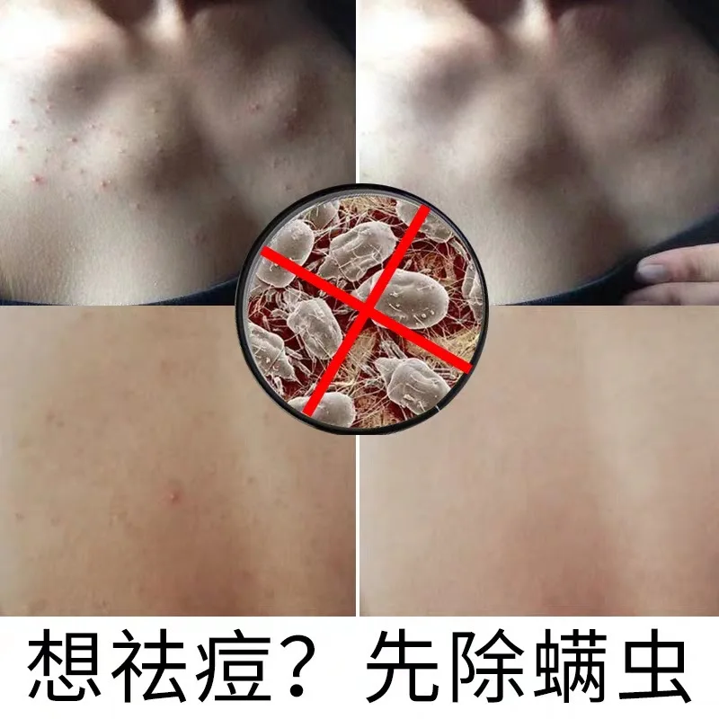 

Di'ai'er anti mite hand made silk soap can remove mites and acne, brighten skin tone, moisturize and shrink pores