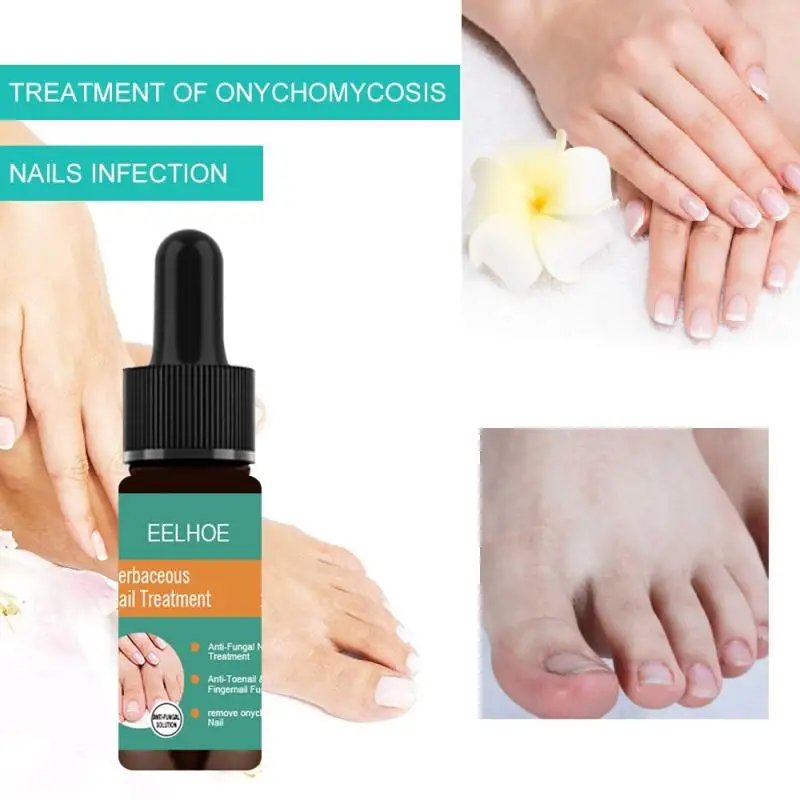 Лечение грибка ногтей Уход за ногами оптовая продажа гель для удаления грибка ногтей против паронихии онихомикоза TSLM1