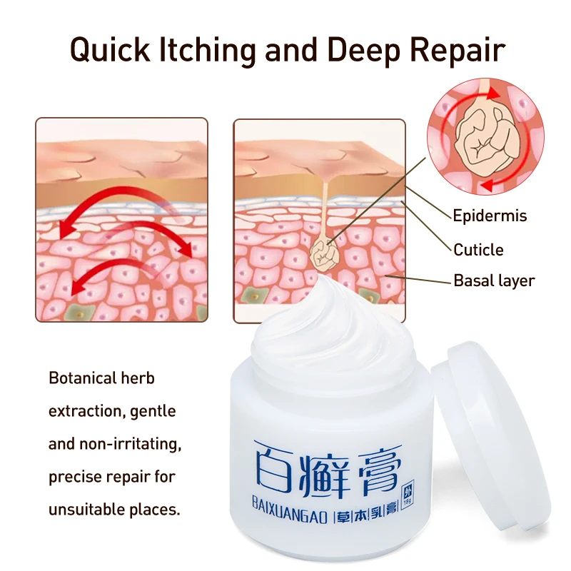 1 шт. уход за кожей травяная мазь псориаз кремы для рук ног эцема дерматит