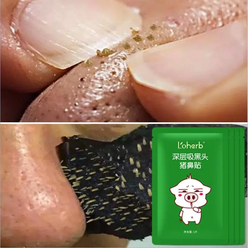 

10pcs Nose Blackhead Remover Mask Pore Cleaner Acne Treatment Mask Deep Nose Pore Cleasing Strips Black Head Remover