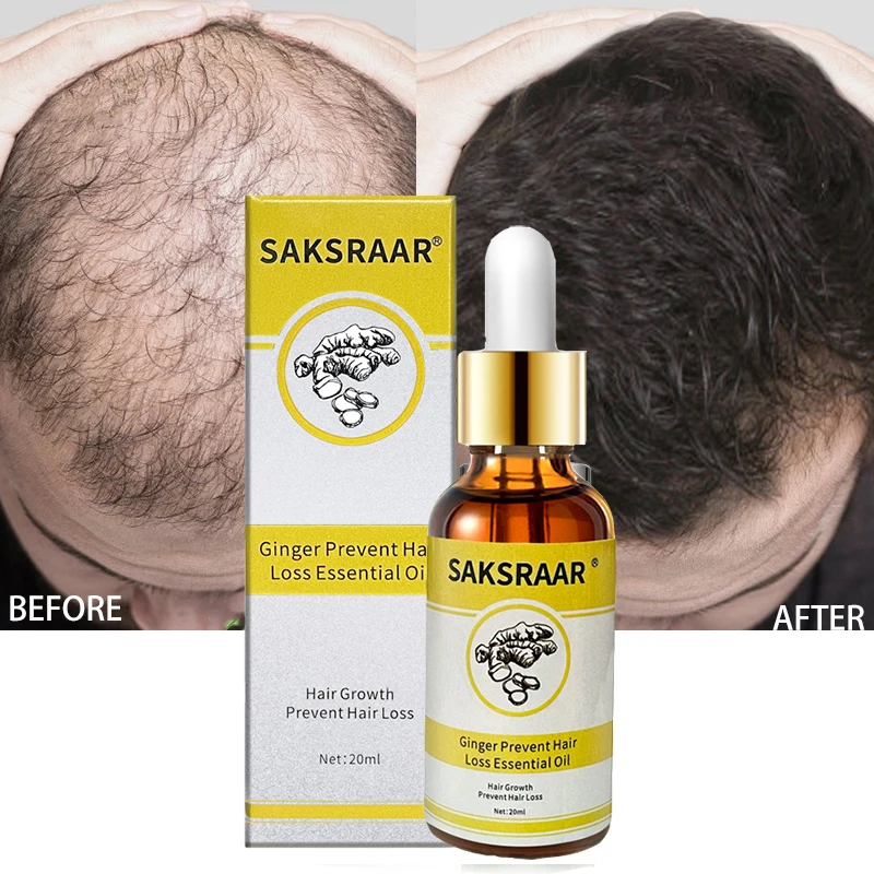 Уход За Волосами Эфирные масла для роста волос экстракт оригинальный