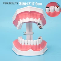 tdoubeauty adult high end decayed tooth model dental caries case model for kindergarten medical school teaching free shipping