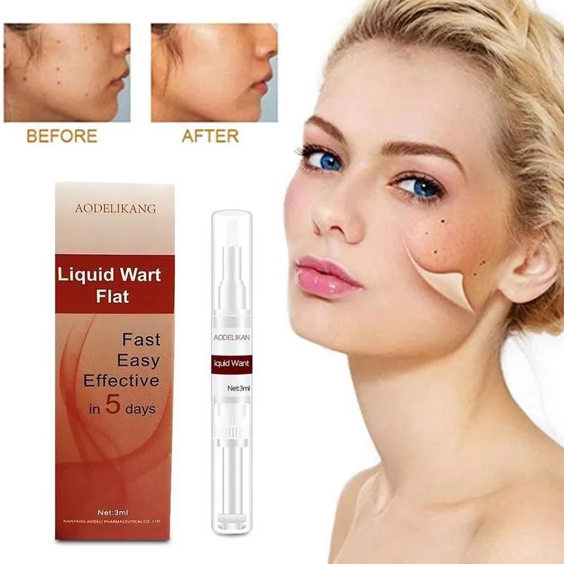 3 мл! Бесплатная доставка! Кожу средство удаления бирок бородавки лечение против