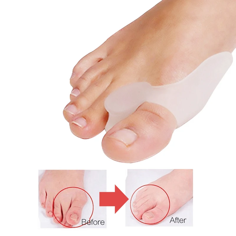 70 Pair Hammer Toes Silicone Bunion Corrector Separator Feet Care Tools Pad Hallux Valgus Protector Orthopedic Straightener