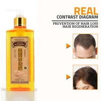 genuine professional hair ginger shampoo 300ml hair regrowth dense fast thicker shampoo anti hair loss product
