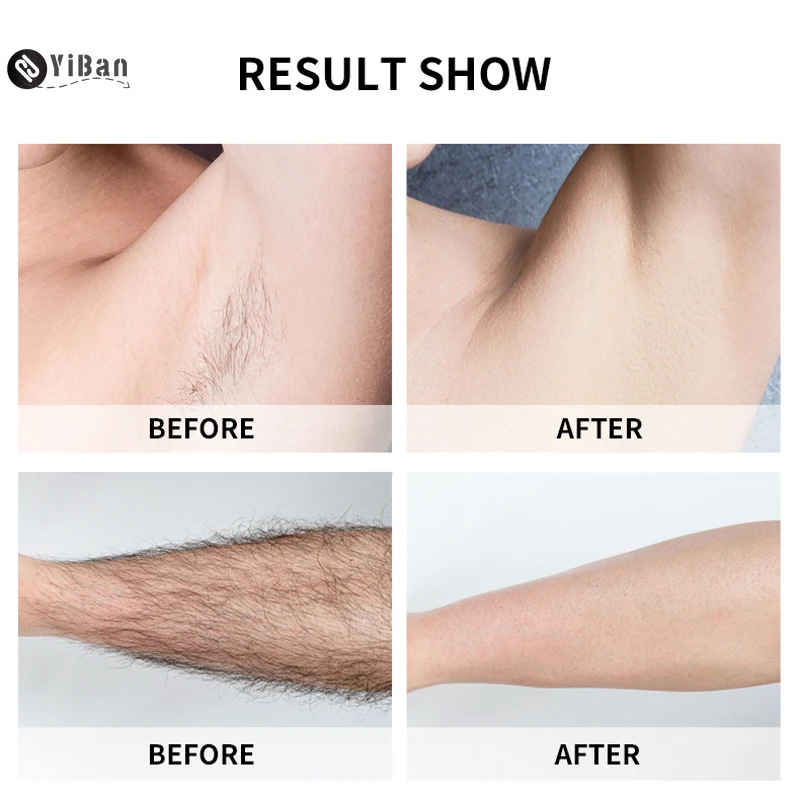 

Kyliebeauty 900000 IPL Depiladora