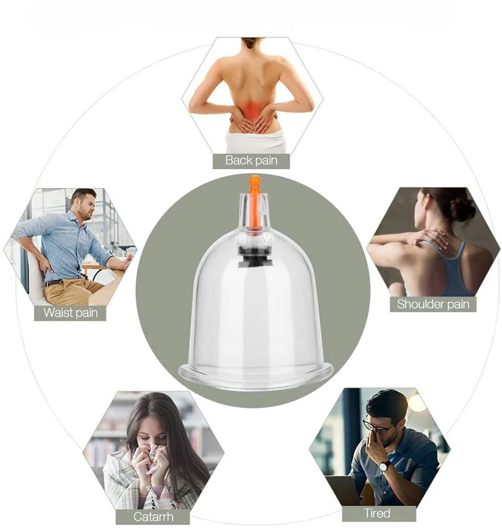 Баночный массаж чашка для терапии комплектов Hijama китайская Акупунктура с